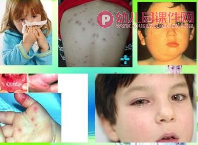 大班安全教育课件PPT《传染病,要预防》PPT课件图片