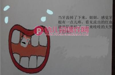 大班健康课件PPT《换牙的故事》PPT课件图片