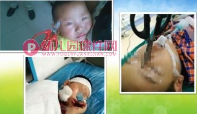 大班生活与健康课件PPT《保护身体宝贝》PPT课件图片