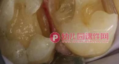 大班健康优质课课件PPT《换牙庆祝会》PPT课件图片