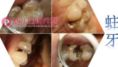 大班健康公开课课件PPT《保护牙齿》PPT课件图片