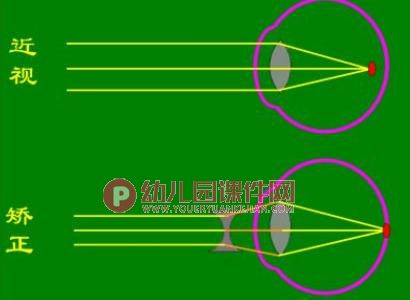 大班健康活动课件PPT《爱护眼睛 保护视力》PPT课件图片