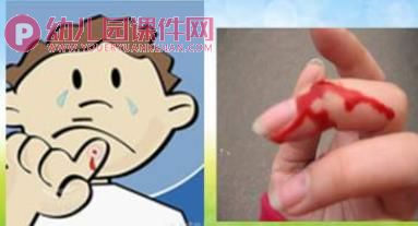 小班安全课件PPT《小手流血了》PPT课件图片