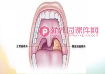 小班安全课件PPT《保护嗓子》PPT课件图片