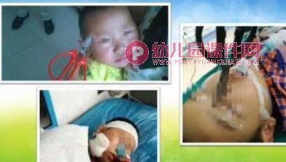 小班安全课件PPT《保护自己》PPT课件图片