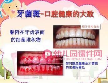 小班健康活动课件PPT《保护牙齿从小做起》PPT课件图片