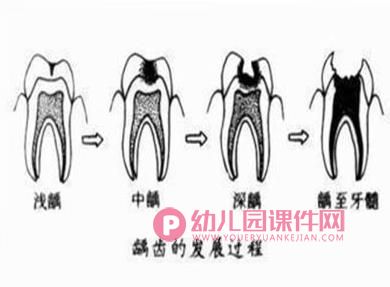 小班健康活动课件PPT《保护牙齿从小做起》PPT课件图片