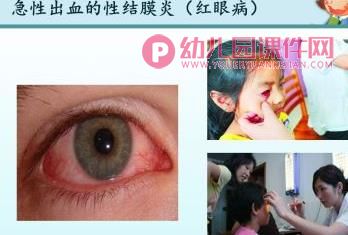 中班健康教育课件PPT《如何有效洗手》PPT课件图片