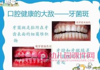 中班健康课件PPT《爱牙小卫士》PPT课件图片