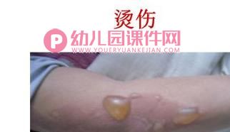 中班健康课件PPT《取暖的安全》PPT课件图片