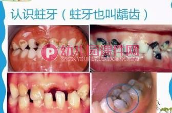 中班健康课件PPT《爱牙小卫士》PPT课件图片