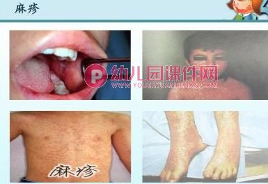 中班健康教育课件PPT《如何有效洗手》PPT课件图片